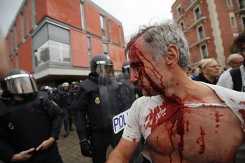 За сегодняшний день в Каталонии пострадало уже 456 человек